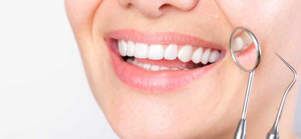 Diseño de sonrisa