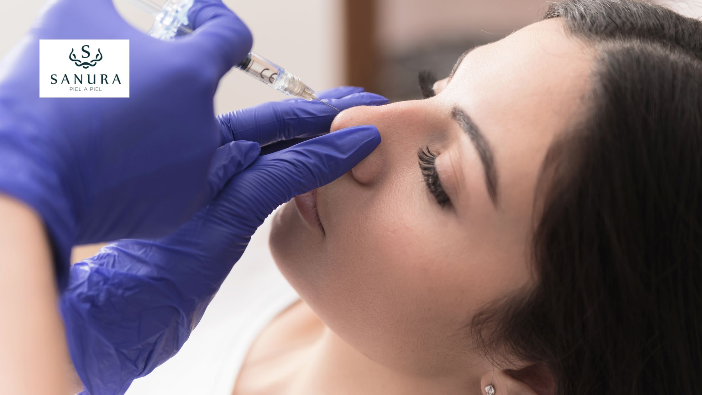 5.2-rinoplastia-quito