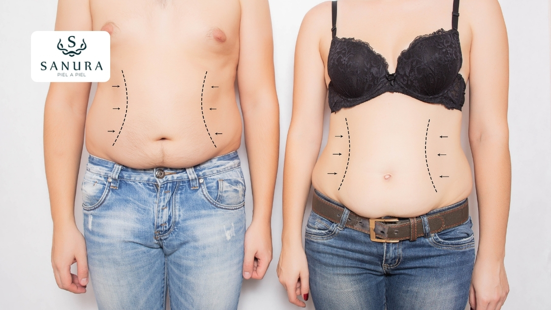 25.2 abdominoplastia quito