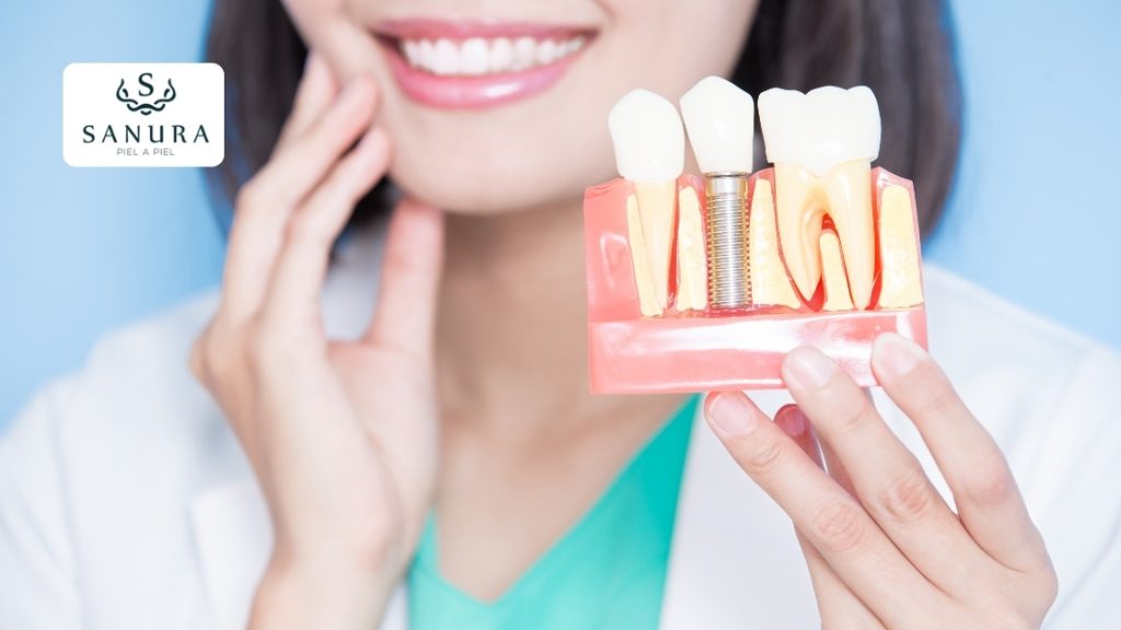 33.2 implantes dentales