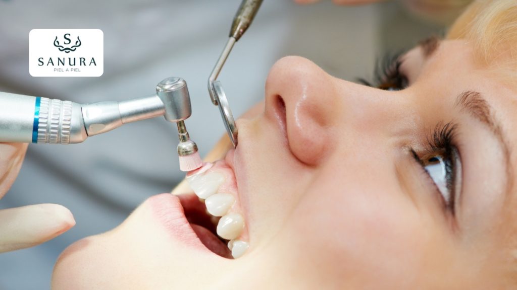 35.2 profilaxis dental que es