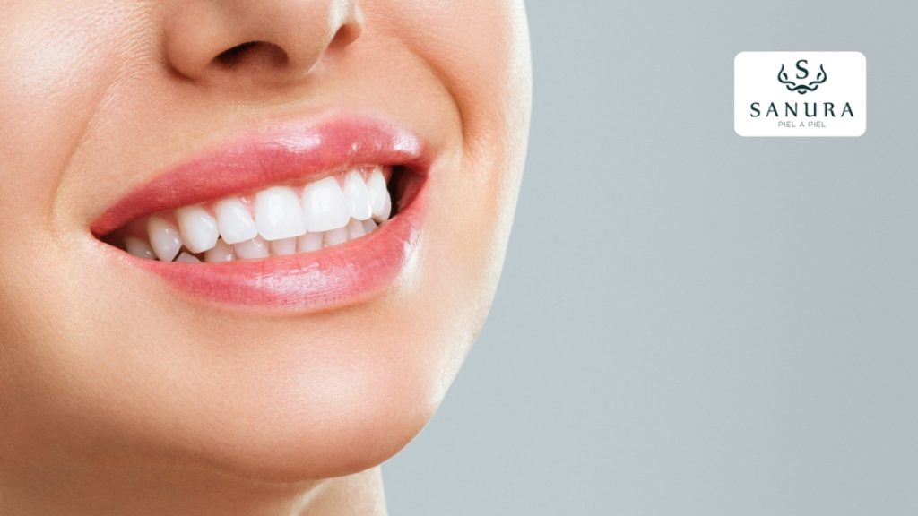 37.1 blanqueamiento dental