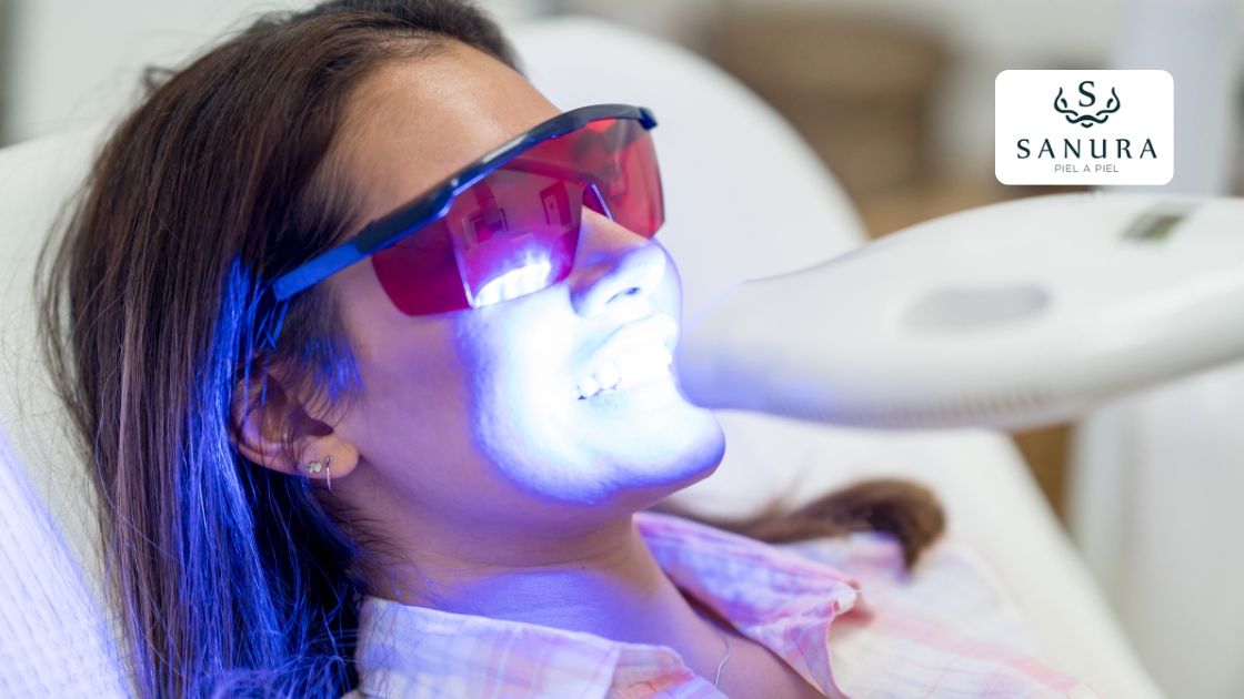 37.2 blanqueamiento dental