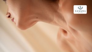 64.1 lunares en el cuello
