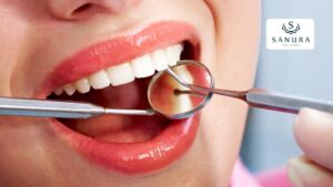 62.1 profilaxis dental