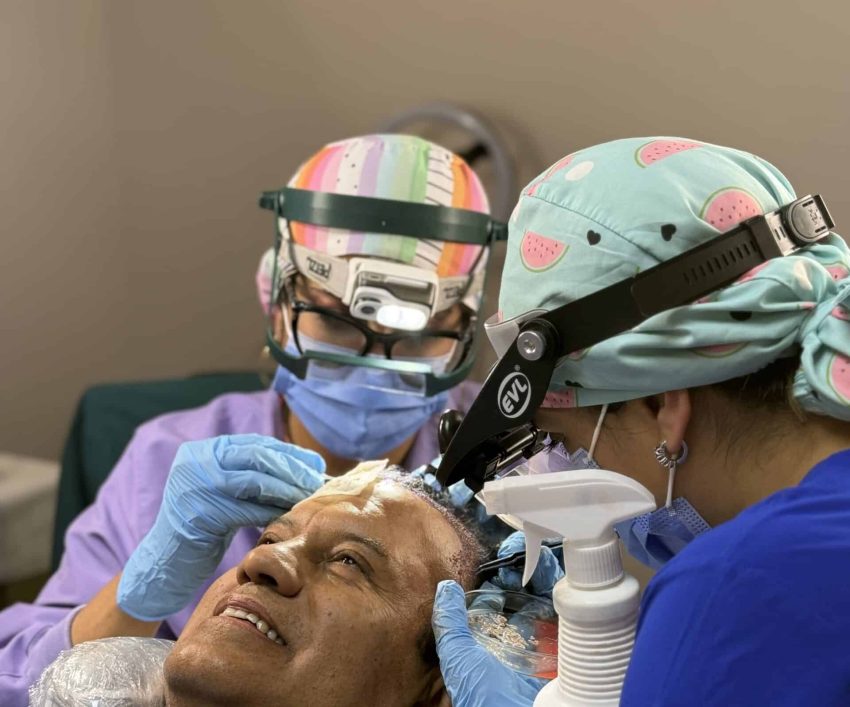 cx transplante capilar cx transplante capilar